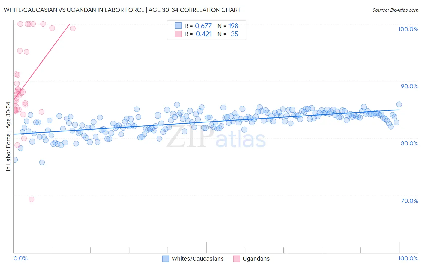 White/Caucasian vs Ugandan In Labor Force | Age 30-34