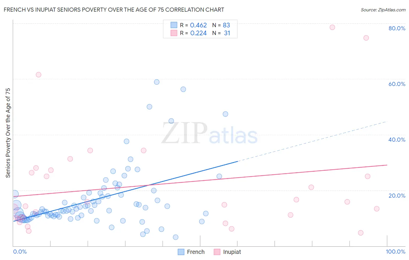 French vs Inupiat Seniors Poverty Over the Age of 75