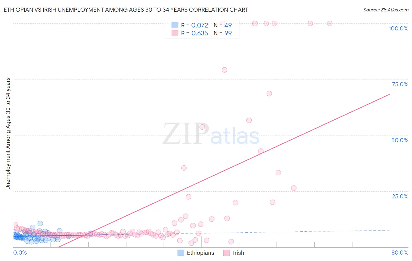 Ethiopian vs Irish Unemployment Among Ages 30 to 34 years