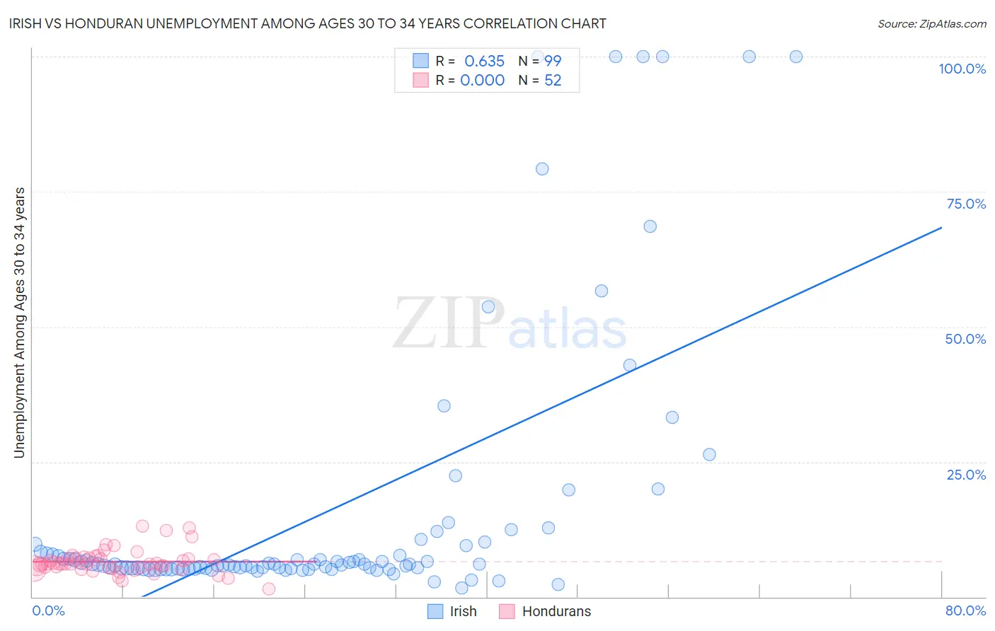 Irish vs Honduran Unemployment Among Ages 30 to 34 years