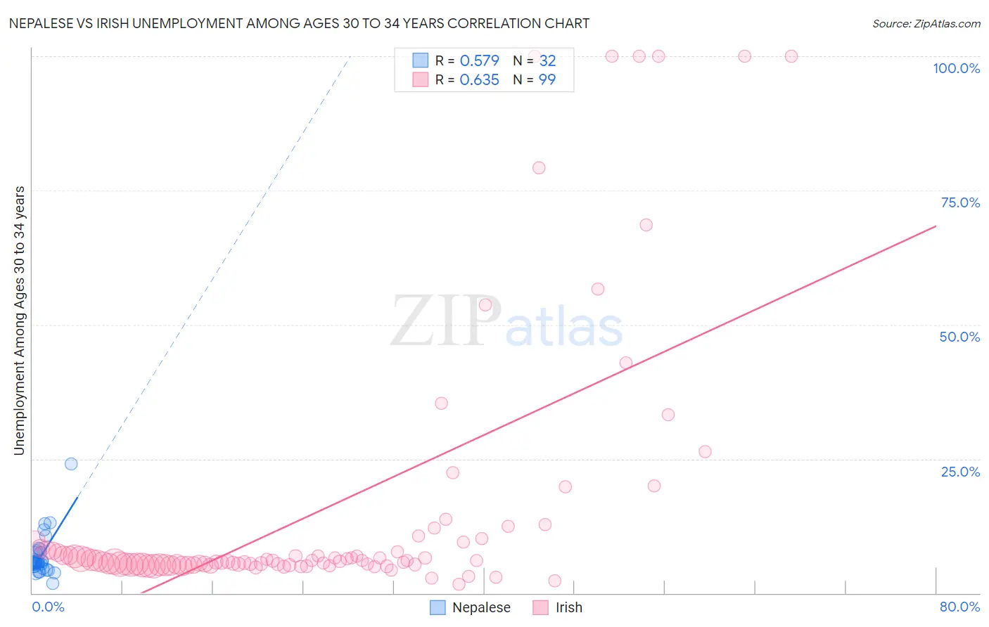 Nepalese vs Irish Unemployment Among Ages 30 to 34 years