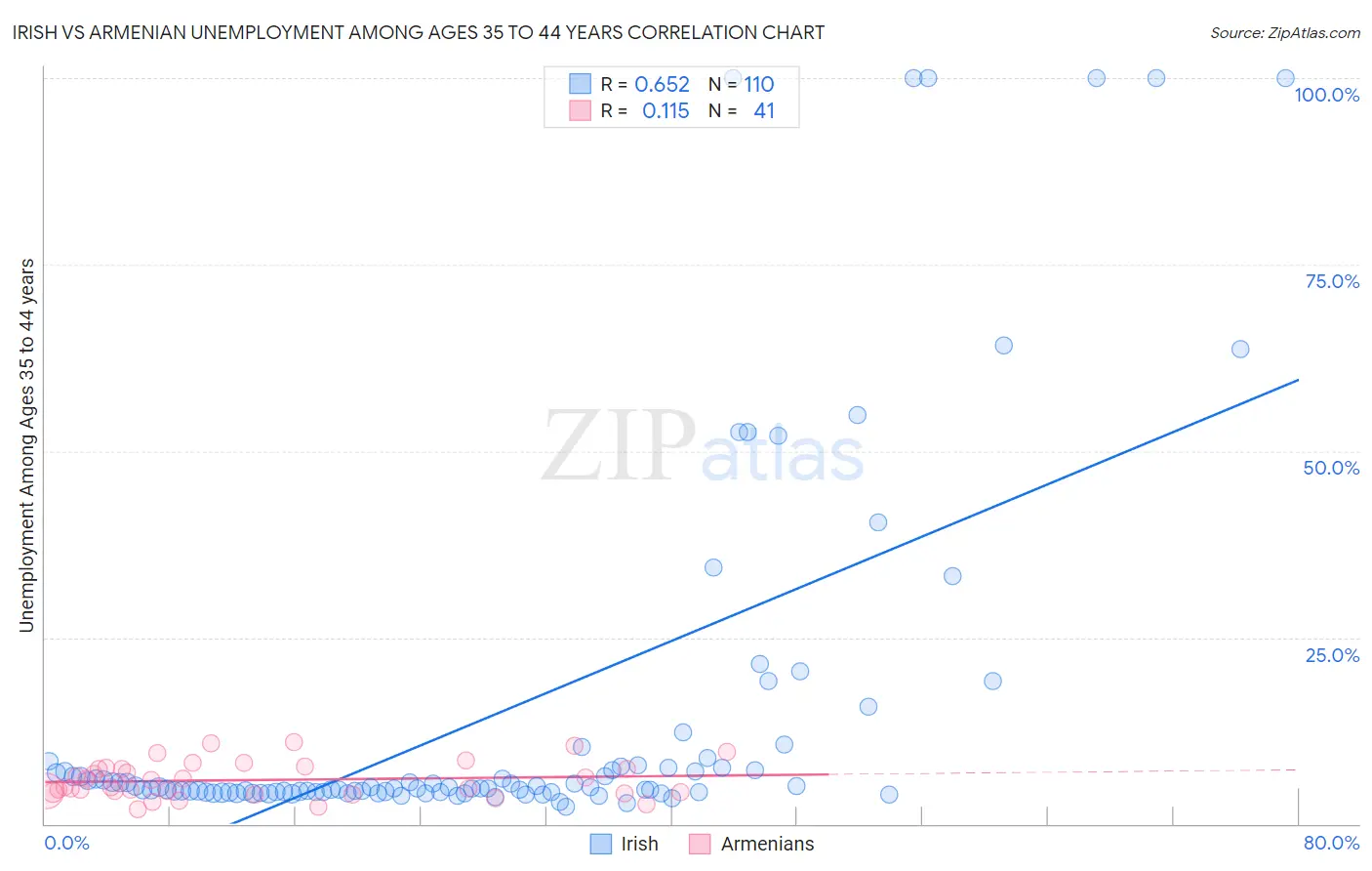 Irish vs Armenian Unemployment Among Ages 35 to 44 years