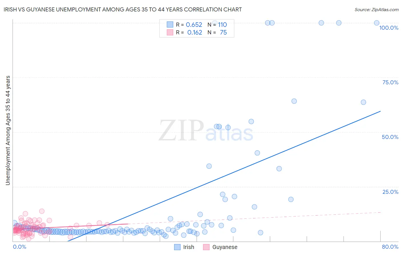 Irish vs Guyanese Unemployment Among Ages 35 to 44 years